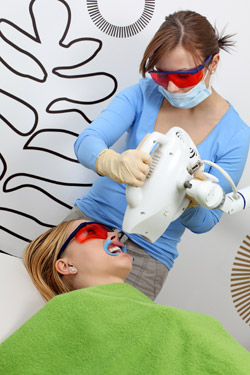 Tandblekning med laser