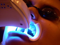 tandblekning med laser